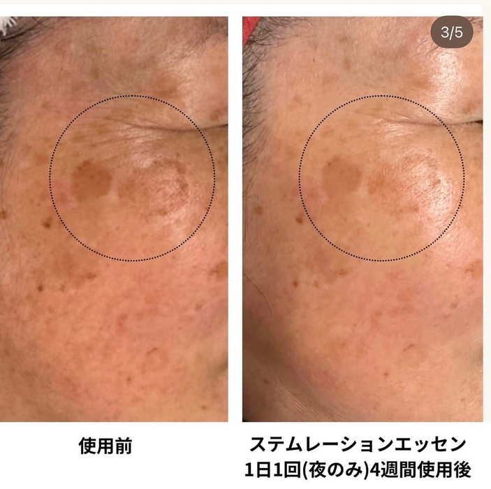 画像1000