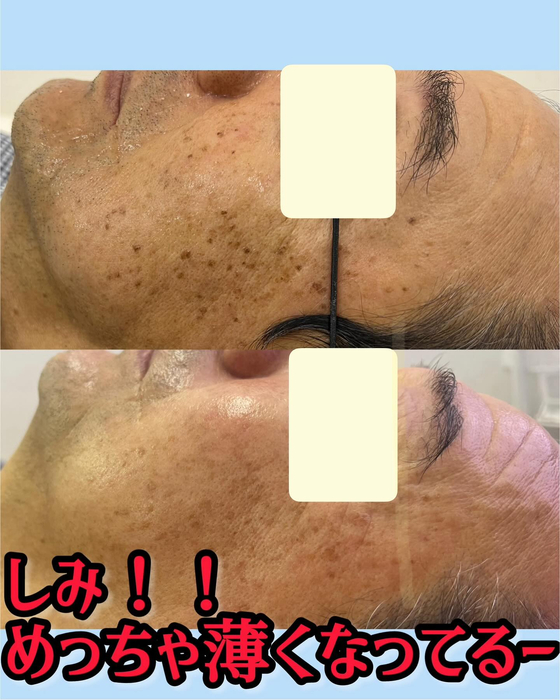 画像1025