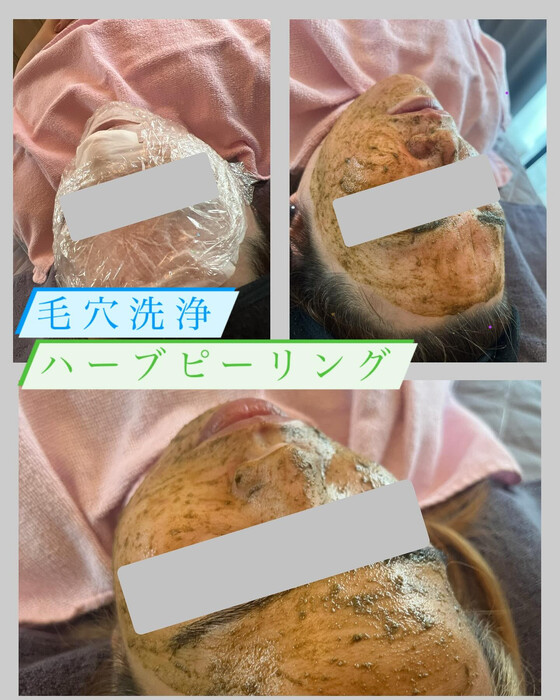 画像1101