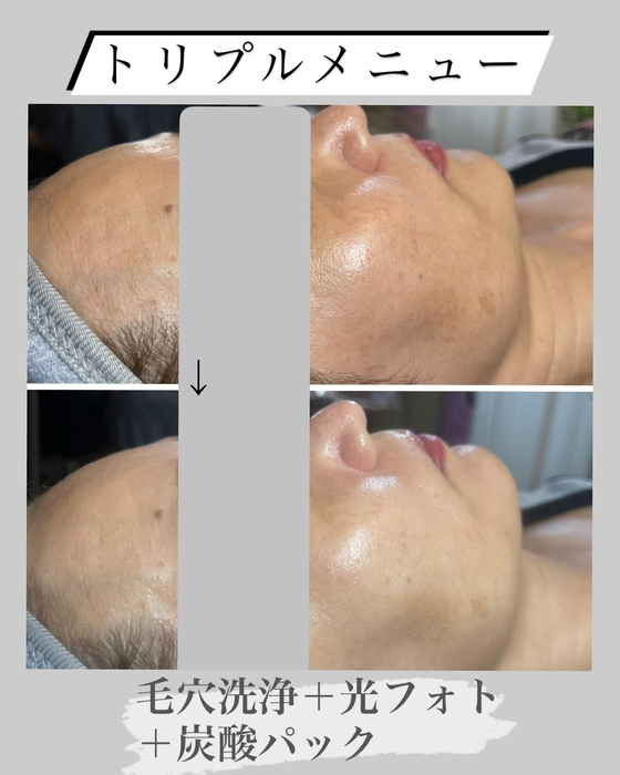 画像1184