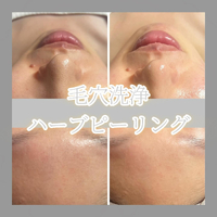 画像1219