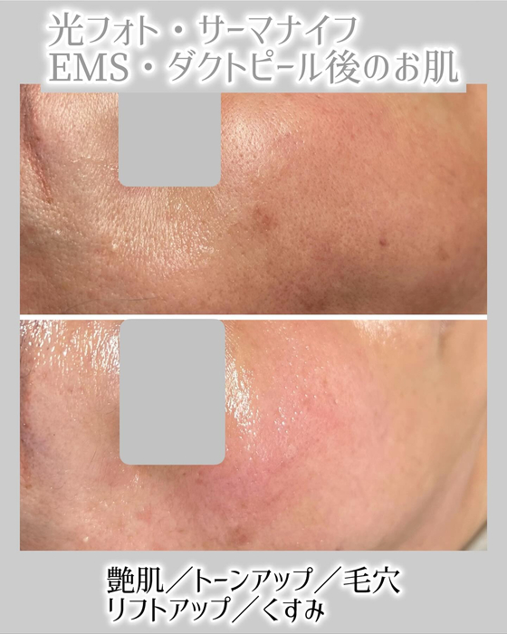 画像1254