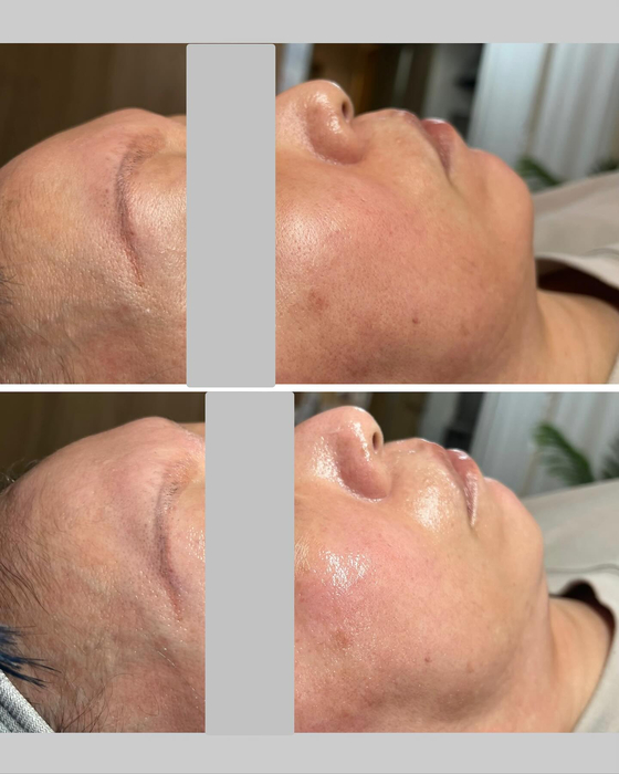 画像1255