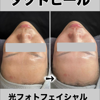画像1274