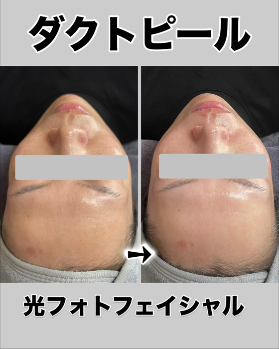 画像1274