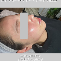 画像1278
