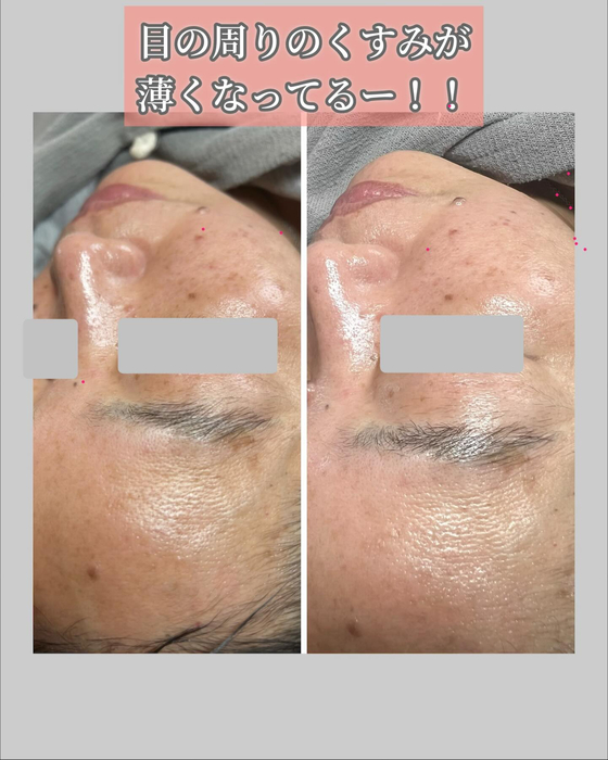 画像1287