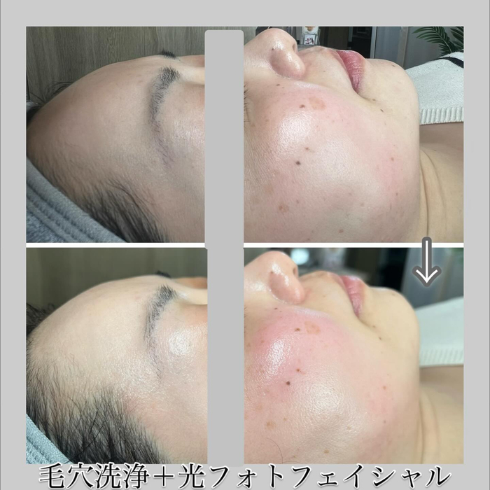 画像1292