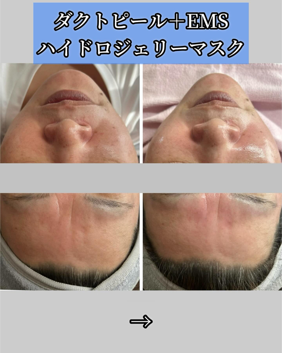 画像1310