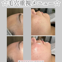 画像1318