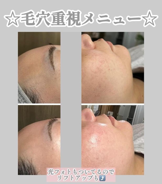 画像1318