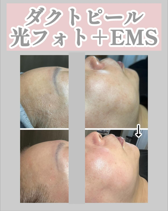 画像1321