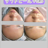 画像1335