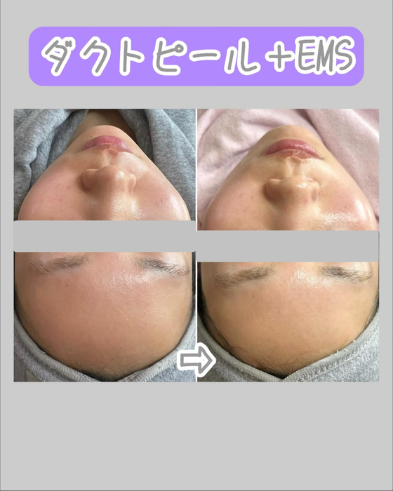 画像1335