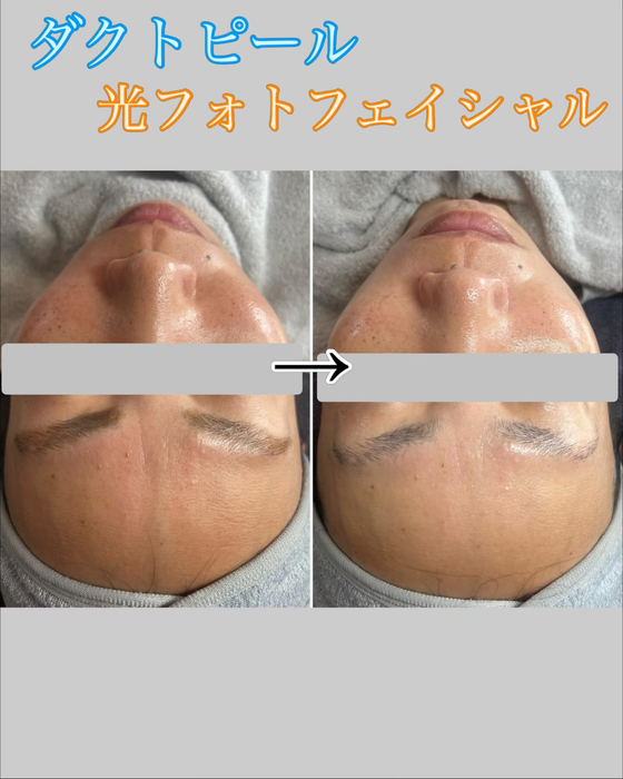 画像1340