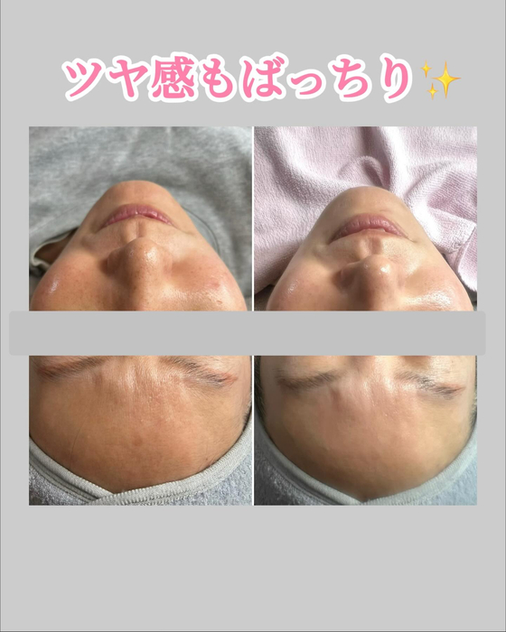 画像1352