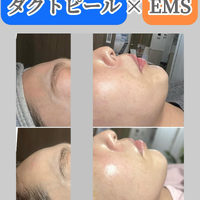 画像1358