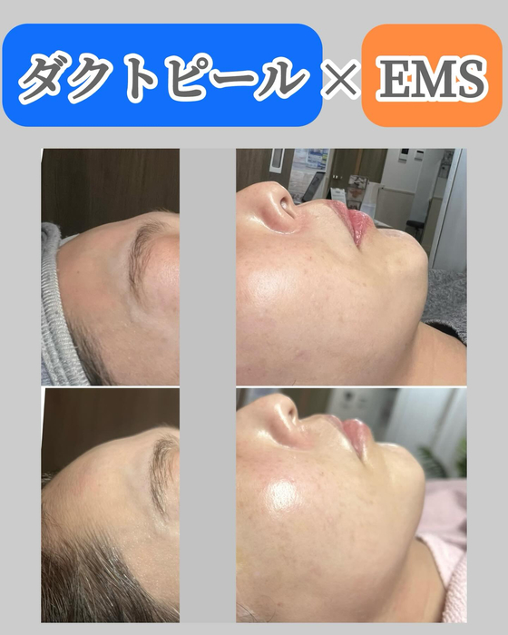 画像1358