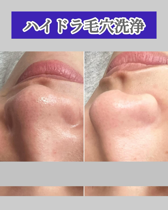 画像1361