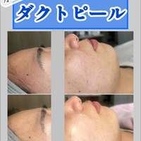 画像1372