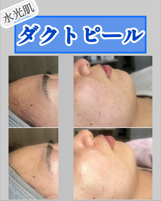 画像1372