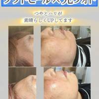 画像1378