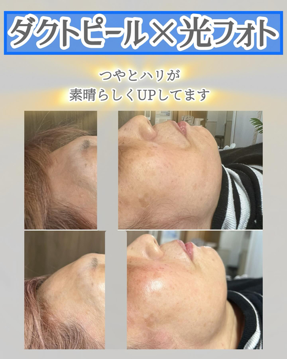 画像1378