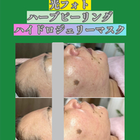 画像1393