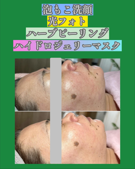 画像1393