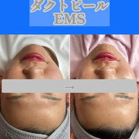 画像1406