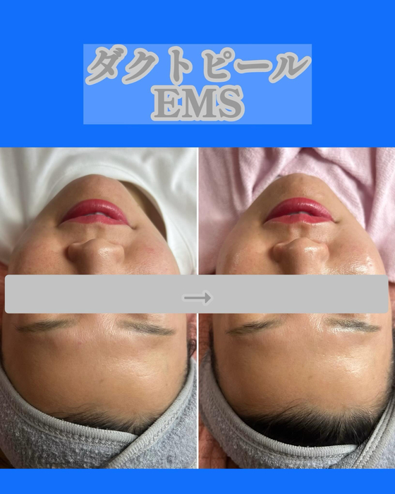 画像1406