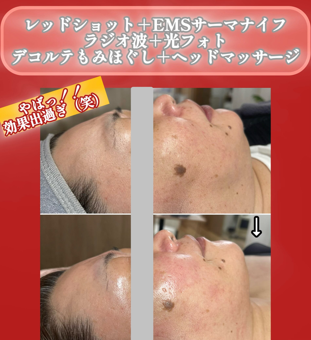 画像1413