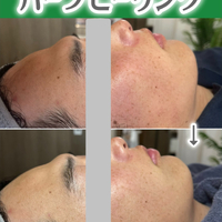 画像1432