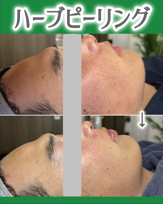 画像1432