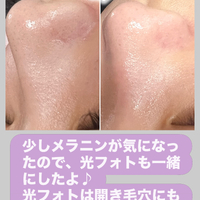 画像1445