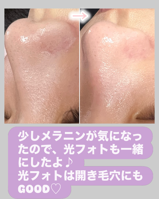 画像1445