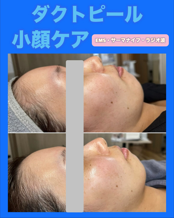 画像1456