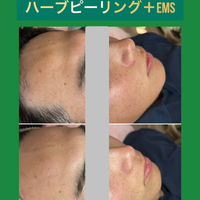 画像1462