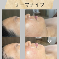 画像1475