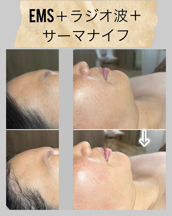 画像1475
