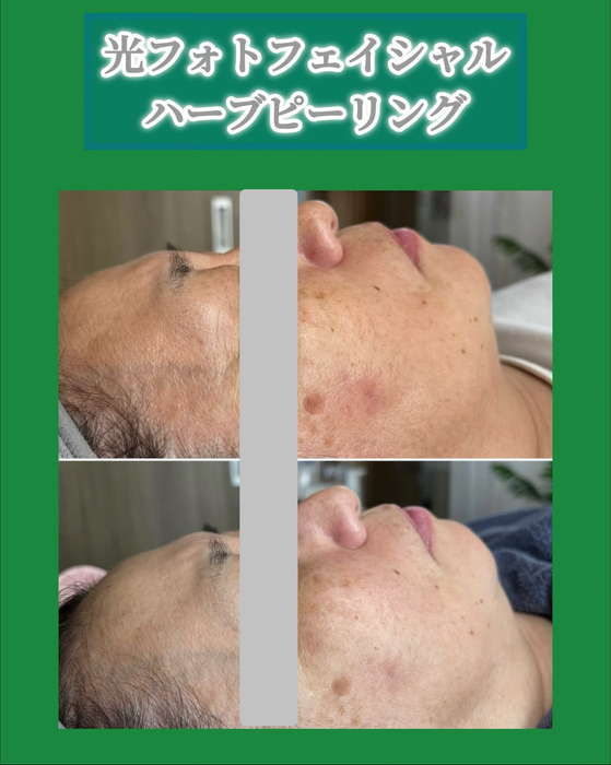 画像1480