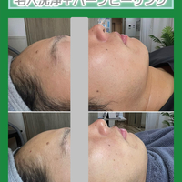 画像1485