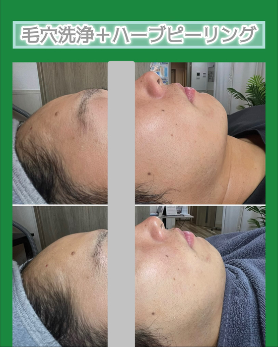 画像1485
