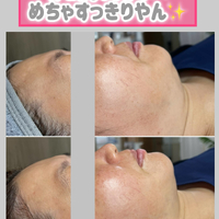 画像1498
