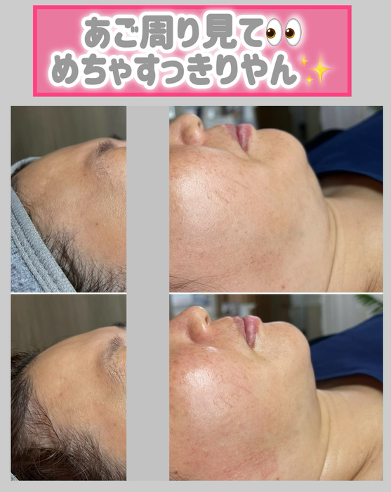 画像1498