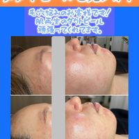 画像1500