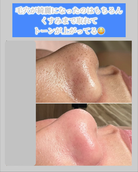 画像1504