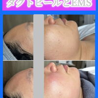 画像1506