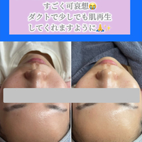 画像1510
