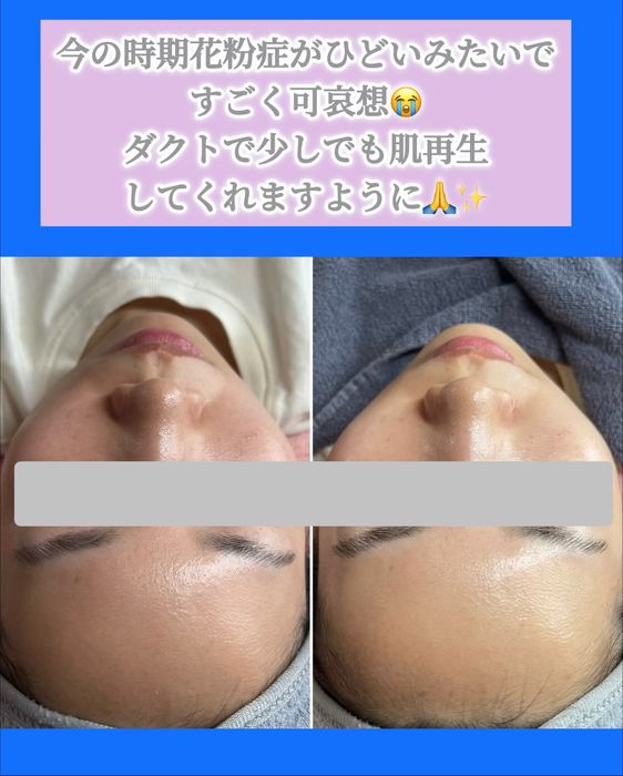 画像1510